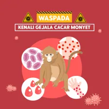 Waspada! Kenali Gejala cacar Monyet