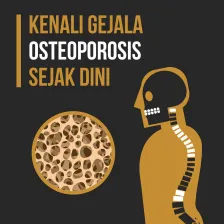 Kenali Gejala Osteoporosis Sejak Dini